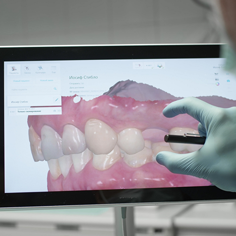 Dentist looking at a digital impression of a patient's teeth