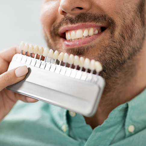Dentist holding a shade guide in front of a patient's smile