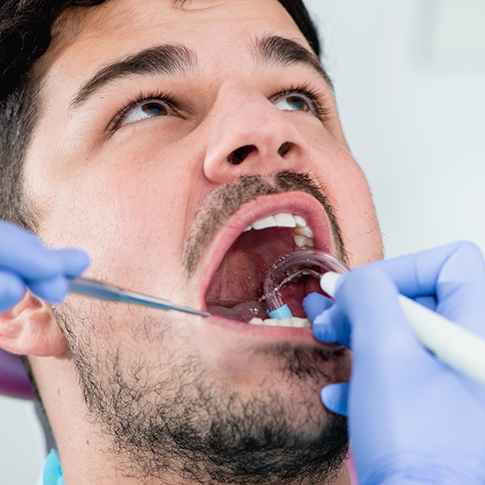 Man receiving a dental exam