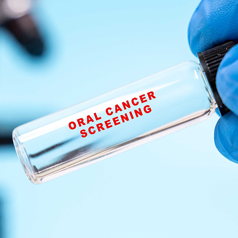 Small glass vial that reads Oral Cancer Screening
