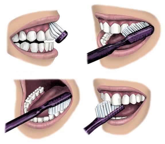 Oral hygiene west maitland dentistry